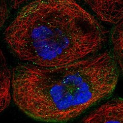 TMEM63B Antibody, Novus Biologicals 0.1mL; Unlabeled:Antibodies, Polyclonal